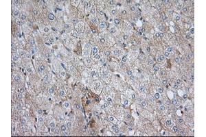 Immunohistochemical staining of paraffin-embedded Human liver tissue using anti-SNX9 mouse monoclonal antibody. (SNX9 antibody)