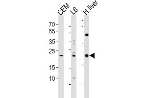 Western blot analysis of lysates from CEM, rat L6 cell line and human liver tissue lysate(from left to right), using PEMT Antibody (N-term) (ABIN650614 and ABIN2844055).
