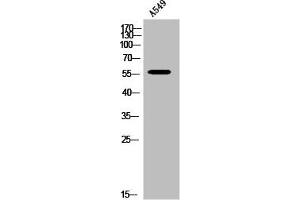 Western Blot analysis of A549 cells using Hepatic Lipase Polyclonal Antibody (LIPC antibody  (Internal Region))