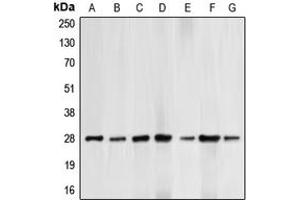 Western blot analysis of BCL2 (pT69) expression in HepG2 UV-treated (A), HeLa (B), HL60 (C), THP1 (D), Jurkat paclitaxel-treated (E), NIH3T3 H2O2-treated (F), PC12 H2O2-treated (G) whole cell lysates. (Bcl-2 antibody  (pSer69))