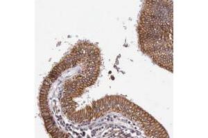 Immunohistochemical staining of human gallbladder with PRICKLE3 polyclonal antibody  shows strong cytoplasmic and membranous positivity in glandular cells at 1:20-1:50 dilution. (PRICKLE3 antibody)