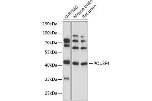 Western blot analysis of extracts of various cell lines, using POU3F4 antibody (ABIN7269496) at 1:1000 dilution. (POU3F4 antibody  (AA 1-190))