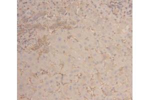 Detection of ACTG in Human Liver Tissue using Polyclonal Antibody to Gamma Actin (ACTG) (Actin, gamma 1 antibody  (AA 1-375))