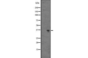 Western blot analysis of GPR77 expression in Hela cell lysate,The lane on the left is treated with the antigen-specific peptide. (GPR77 antibody  (C-Term))