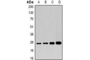 Western blot analysis of APIP expression in 22RV1 (A), mouse heart (B), mouse liver (C), rat stomach (D) whole cell lysates. (APIP antibody)