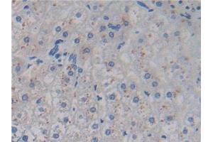 Immunohistochemistry (IHC) image for anti-Anti-Mullerian Hormone (AMH) antibody (ABIN7428011)