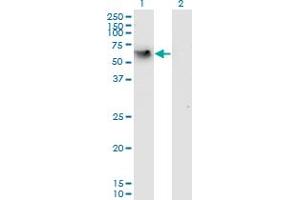 Western Blot analysis of CD44 expression in transfected 293T cell line by CD44 monoclonal antibody (M05), clone 2H5. (CD44 antibody  (AA 1-699))