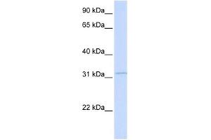 RDH12 antibody used at 1 ug/ml to detect target protein. (RDH12 antibody)