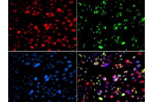Immunofluorescence analysis of GFP-RNF168 transgenic U2OS cells using PNKP antibody. (PNKP antibody  (AA 60-320))