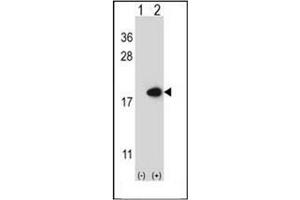 Western blot analysis of FABP2 (arrow) using FABP2 Antibody (N-term) Cat. (FABP2 antibody  (N-Term))