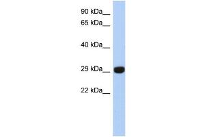 WB Suggested Anti-FN3KRP Antibody Titration: 0.