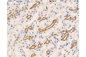 Immunohistochemistry analysis of paraffin-embedded mouse kidney using Mineralocorticoid receptor Polyclonal Antibody at dilution of 1:300. (NR3C2 antibody)