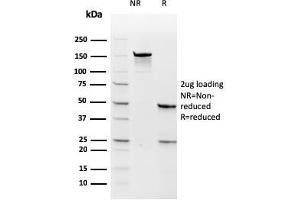 SDS-PAGE Analysis Purified TYMS Recombinant Mouse Monoclonal Antibody (rTYMS/1884). (Recombinant TYMS antibody  (AA 60-174))