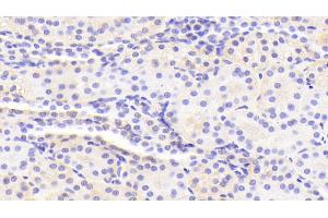 Immunohistochemistry (IHC) image for anti-Guanine Deaminase (GDA) (AA 1-454) antibody (ABIN7441532)