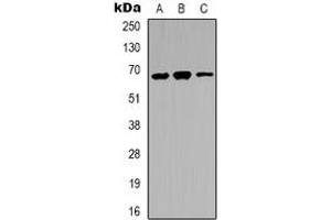 Western blot analysis of IRAK3 expression in LOVO (A), A431 (B), K562 (C) whole cell lysates. (IRAK3 antibody  (C-Term))