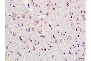 Formalin-fixed and paraffin embedded rat brain tissue labeled with Anti-E2F1 Polyclonal Antibody , Unconjugated at 1:200, followed by conjugation to the secondary antibody and DAB staining