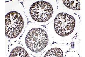 IHC analysis of PARK7 / DJ1 using anti-PARK7 / DJ1 antibody . (PARK7/DJ1 antibody  (AA 2-189))