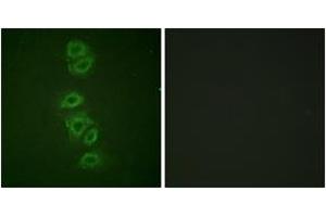 Immunofluorescence analysis of A549 cells, using PP2A-alpha (Phospho-Tyr307) Antibody. (PPP2CA antibody  (pTyr307))