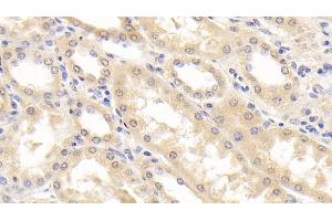 Detection of RBP4 in Human Kidney Tissue using Monoclonal Antibody to Retinol Binding Protein 4 (RBP4) (RBP4 antibody  (AA 18-201))