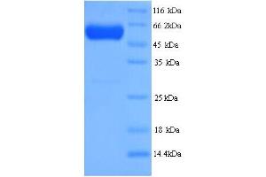 SDS-PAGE (SDS) image for Septin 7 (SEPT7) (AA 2-437) protein (His tag) (ABIN4976003) (Septin 7 Protein (SEPT7) (AA 2-437) (His tag))