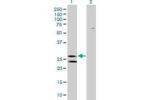 Western Blot analysis of ATP5F1 expression in transfected 293T cell line by ATP5F1 MaxPab polyclonal antibody. (ATP5F1 antibody  (AA 1-256))