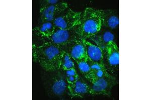 IF analysis of VEGF Receptor 3 using anti-VEGF Receptor 3 antibody (ABIN5693136). (FLT4 antibody  (AA 25-259))