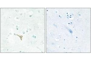 Immunohistochemistry analysis of paraffin-embedded human brain tissue, using RECK Antibody. (RECK antibody  (AA 21-70))