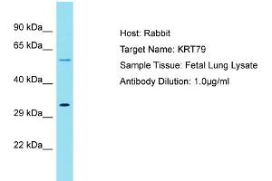 Host: Rabbit Target Name: KRT79 Sample Tissue: Human Fetal Lung Antibody Dilution: 1ug/ml (Cytokeratin 79 antibody  (C-Term))