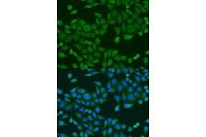 Immunofluorescence analysis of U2OS cells using RPS27A antibody (ABIN1874657) at dilution of 1:100.