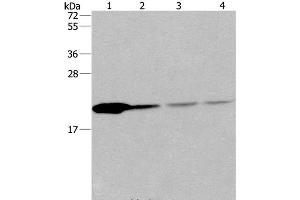 Western Blot analysis of Human fetal liver tissue and 293T cell, Human liver cancer tissue and hela cell using PPIB Polyclonal Antibody at dilution of 1:500 (PPIB antibody)
