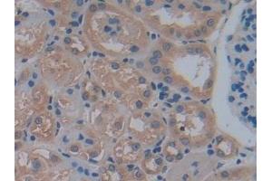 Immunohistochemistry (IHC) image for anti-phosphofructokinase, Platelet (PFKP) (AA 247-473) antibody (ABIN7443050)