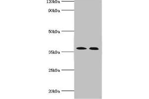 Western blot All lanes: Carbonic anhydrase 14 antibody at 5 μg/mL Lane 1: Mouse liver tissue Lane 2: Jurkat whole cell lysate Secondary Goat polyclonal to rabbit IgG at 1/10000 dilution Predicted band size: 38 kDa Observed band size: 38 kDa