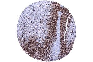 CD22 positive B lymphocytes predominate in the white pulp but are only sparse in the red pulp (Recombinant CD22 antibody  (AA 52-178))