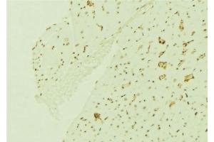 ABIN6276756 at 1/100 staining Mouse brain tissue by IHC-P. (ERCC5 antibody  (N-Term))