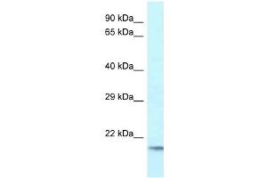 Western Blot showing UBE2V1 antibody used at a concentration of 1 ug/ml against Fetal Brain Lysate