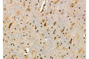 ABIN6264854 and ABIN6277024 at 1/100 staining Mouse brain tissue by IHC-P.