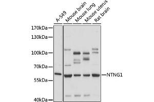 Western blot analysis of extracts of various cell lines, using NTNG1 antibody (ABIN7268853) at 1:1000 dilution. (Netrin G1 antibody  (AA 29-300))