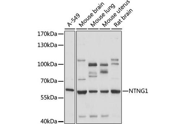 Netrin G1 Antikörper  (AA 29-300)