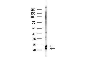 anti-Transgelin 2 (TAGLN2) (Internal Region) antibody
