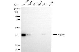 anti-Pleckstrin Homology-Like Domain, Family A, Member 1 (PHLDA1) antibody