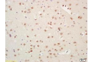 Formalin-fixed and paraffin embedded rat brain labeled with Rabbit Anti Histone H3 Polyclonal Antibody, Unconjugated (ABIN739109) at 1:200 followed by conjugation to the secondary antibody and DAB staining