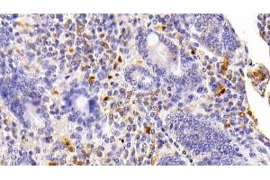 Detection of S100B in Bovine Small intestine Tissue using Polyclonal Antibody to S100 Calcium Binding Protein B (S100B)