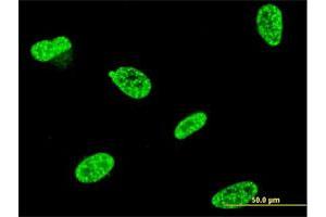 Immunofluorescence of monoclonal antibody to TP53RK on HeLa cell. (TP53RK antibody  (AA 154-253))