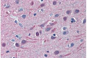 Human Brain, Cortex: Formalin-Fixed, Paraffin-Embedded (FFPE) (TUBB2A antibody  (AA 1-446))