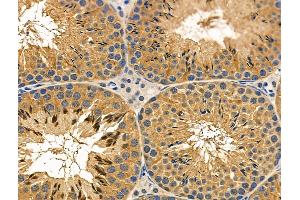 ABIN6257514 and ABIN6276058 at 1/100 staining Mouse testis tissue by IHC-P.