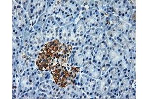 Immunohistochemical staining of paraffin-embedded Kidney tissue using anti-PLEKmouse monoclonal antibody. (Pleckstrin antibody)