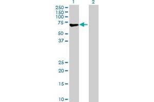 Western Blot analysis of CNKSR3 expression in transfected 293T cell line by CNKSR3 MaxPab polyclonal antibody. (CNKSR3 antibody  (AA 1-555))