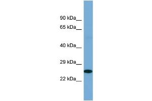 Host: Rabbit Target Name: POU2F3 Sample Type: Fetal Kidney lysates Antibody Dilution: 1. (POU2F3 antibody  (C-Term))
