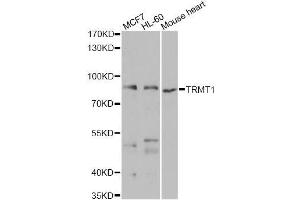 Western blot analysis of extracts of various cell lines, using TRMT1 antibody (ABIN5975089) at 1/1000 dilution. (TRMT1 antibody)