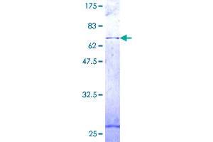 COX15 Protein (AA 1-410) (GST tag)